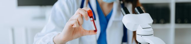 Diagnosta laboratoryjny bada próbkę krwi pod kątem stężenia ferrytyny