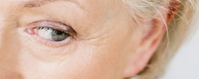 Osoba 55+ ma zmarszczki wokół oczu